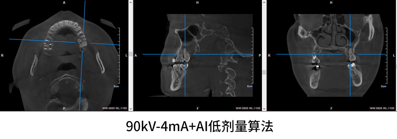 劑量對(duì)比動(dòng)圖.gif